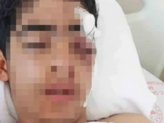 Akran zorbalığına bir yenisi eklendi: 15 yaşındaki çocuk… 2026 Akran zorbalığına bir yenisi eklendi: 15 yaşındaki çocuk... 2026