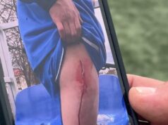 Trauma pasibaigusios futbolo varžybos Alytuje: keturiolikmetis ligoninėje, tėvai ieško teisybės 2026 Trauma pasibaigusios futbolo varžybos Alytuje: keturiolikmetis ligoninėje, tėvai ieško teisybės 2026