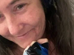 Jayme Stephen, il dramma: calpesta un biscotto per cani e le amputano una gamba 2026 Jayme Stephen, il dramma: calpesta un biscotto per cani e le amputano una gamba 2026