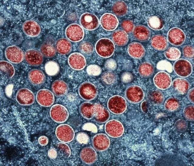 NIH researchers charged with trying to smuggle monkeypox into US: DOJ 2026