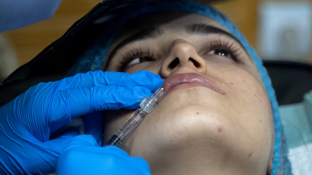 Inspectie waarschuwt voor botox en fillers tijdens introductieweken studenten 2026