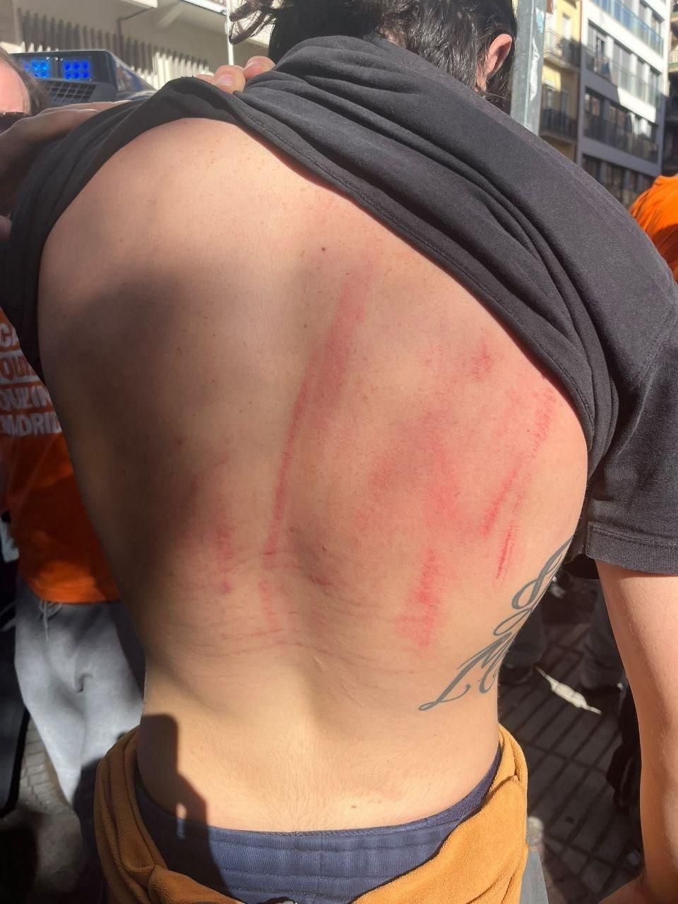Delegación del gobierno abre una investigación por posibles excesos policiales en el desahucio de maricarmen 2026 - justicia - iustitia. Bg Uno de los activistas muestra golpes y rozaduras en la espalda después de ser desalojado del desahucio