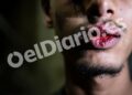 Fotos | golpes y rostros ensangrentados: las imágenes de los migrantes que denuncian palizas de militares en ceuta 2026 - justice - iustitia. Bg Fotos | golpes y rostros ensangrentados: las imágenes de los migrantes que denuncian palizas de militares en ceuta 2026