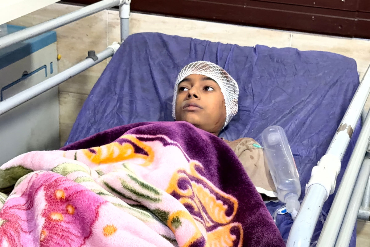 分析によると、イランの結婚式で起きた死者を伴う爆発は、米軍の弾薬が直撃した可能性が高い 2026 - 正義 In this picture obtained by afp from the iranian news agency tasnim on september 2, 2026 a child lies on a hospital bed receiving treatment following injuries from an overnight strike in kuhestak, sirik county, in iran's southern hormozgan province on september 2, 2026.