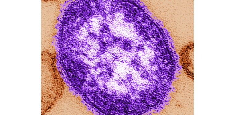 Dupage county confirms measles case for vaccinated resident who traveled through o'hare airport 2026