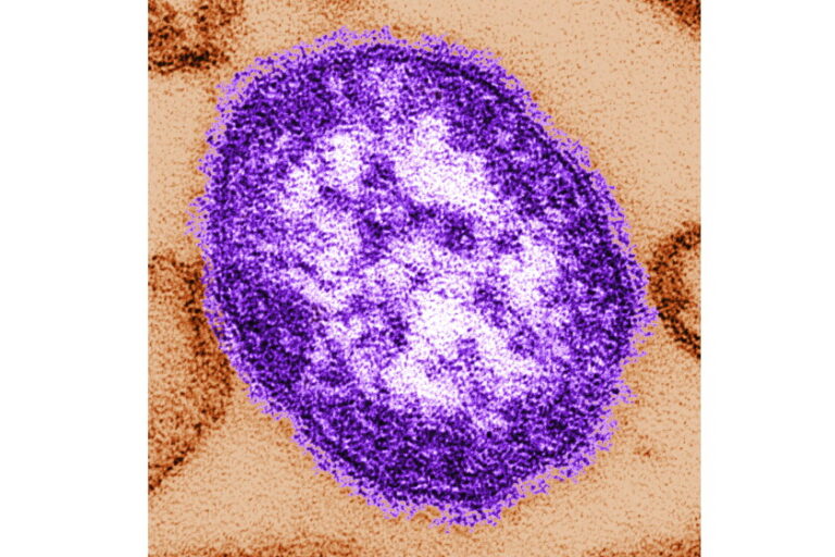 Dupage county confirms measles case for vaccinated resident who traveled through o'hare airport 2026