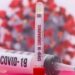 Експерт: covid-19 в момента е по-активен от грипа 2026